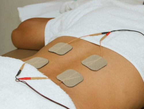Woman lying on back with Acupuncture TENS machine in Auckland