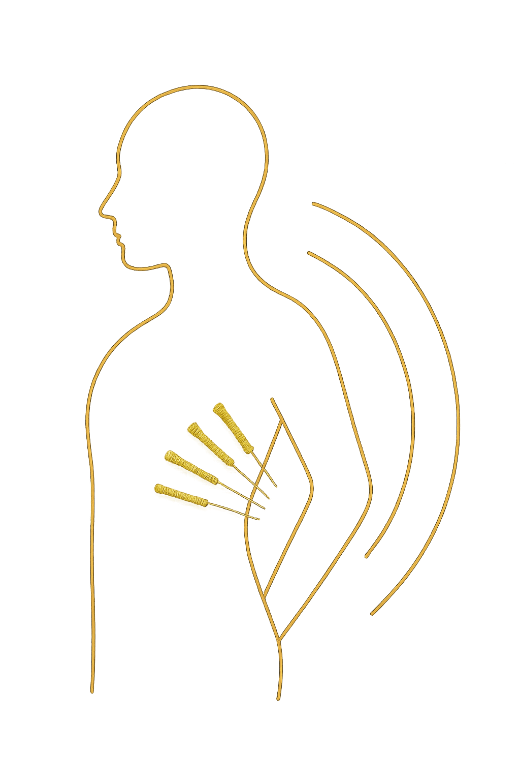 Acupuncture - Auckland - Parnell - Interactive Therapies