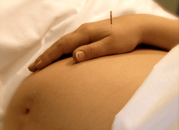Needle in ahnd on a pregnant woman